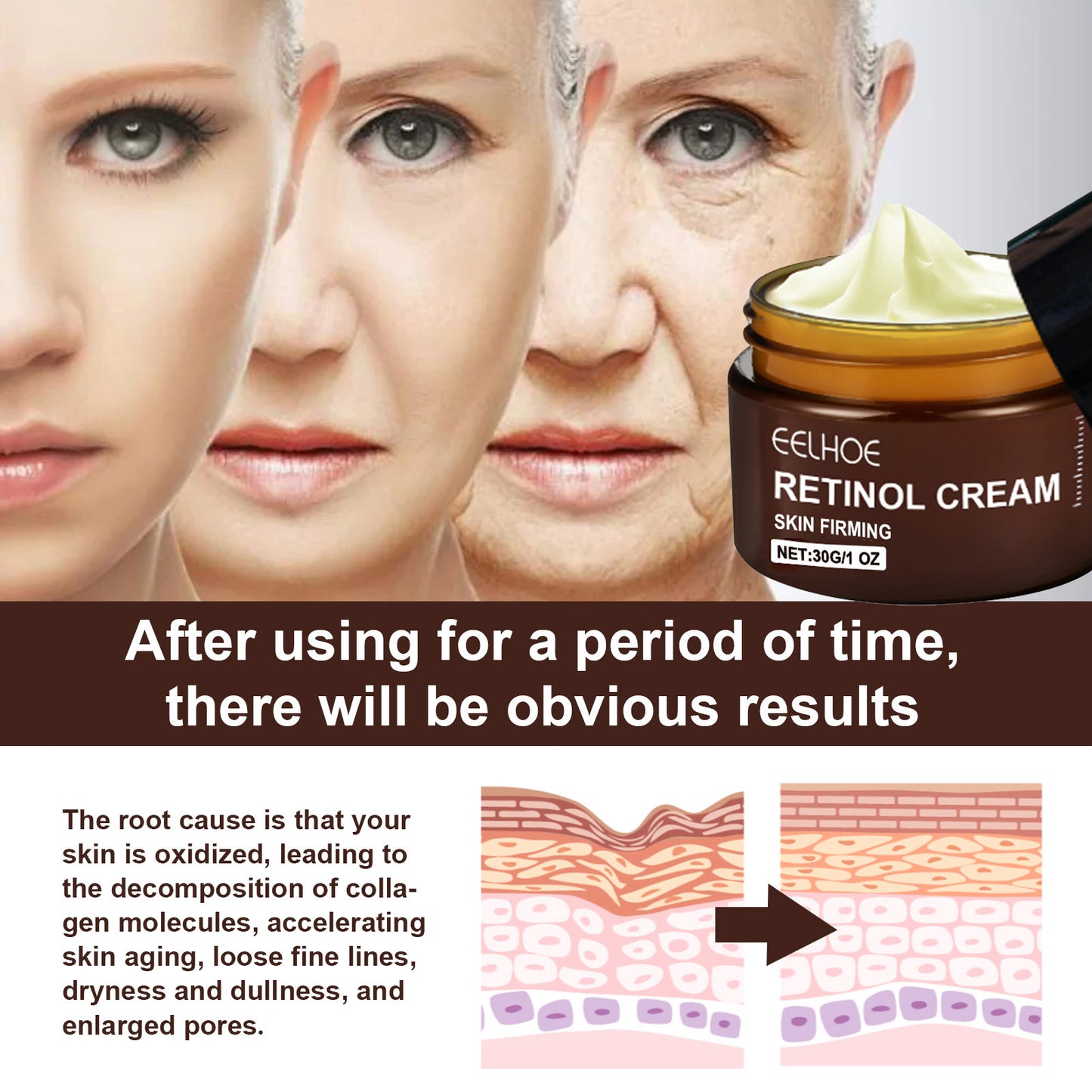 EELHOE Retinol Cream - The Nex Store