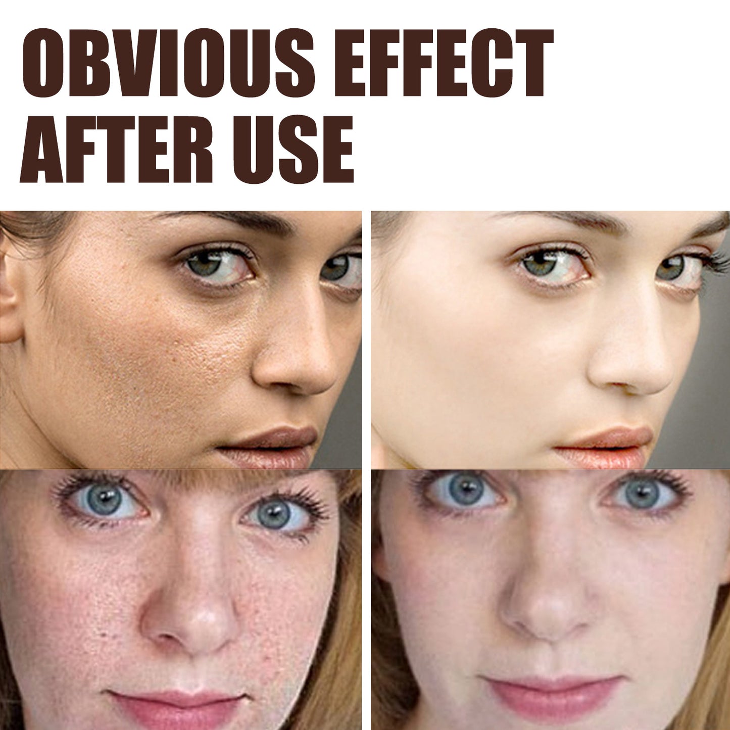 EELHOE Retinol Cream - The Nex Store